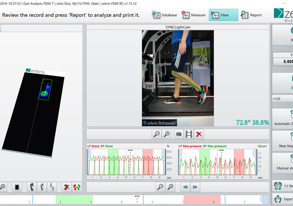 en ganganalyse fdm t kamera mit schuhen