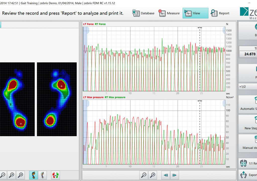 zebris 분석 화면1