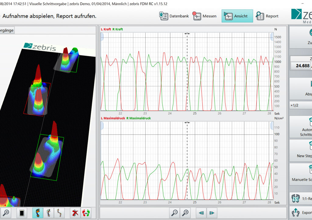 zebris 분석 화면2