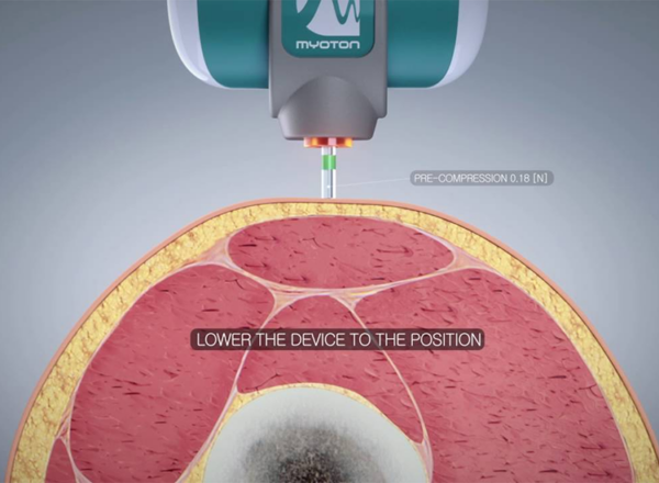 MyotonPRO measurement